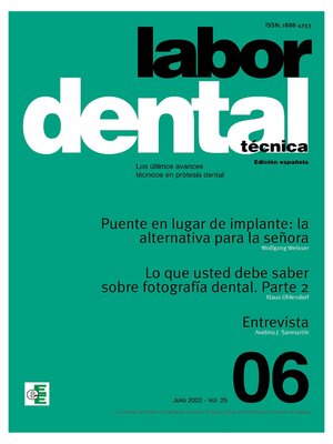 cover image of Labor Dental Técnica Nº6 Volume25
